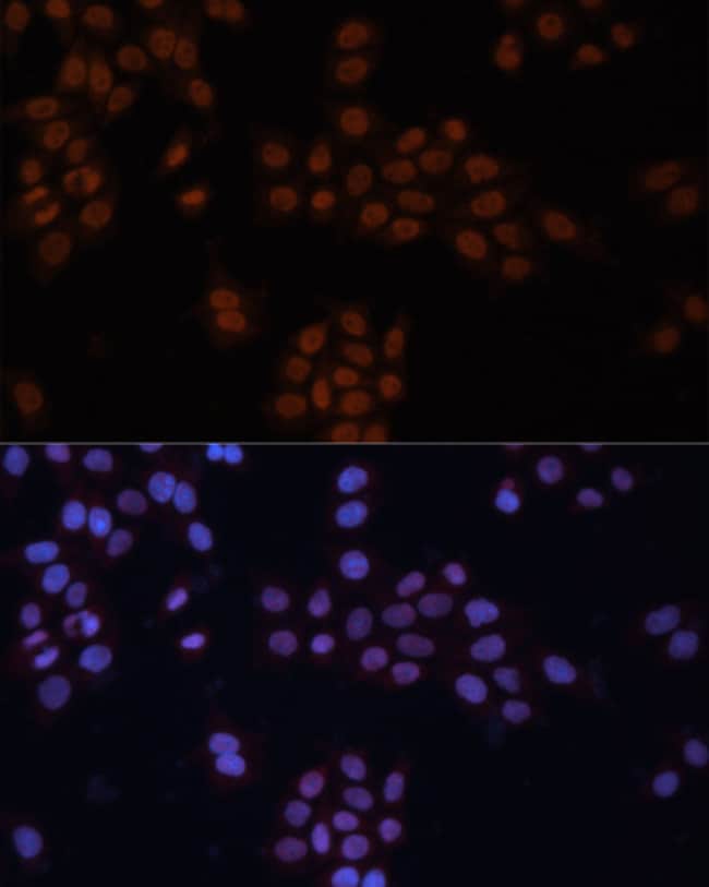 100UL GTF2I ANTIBODY 100 ul
