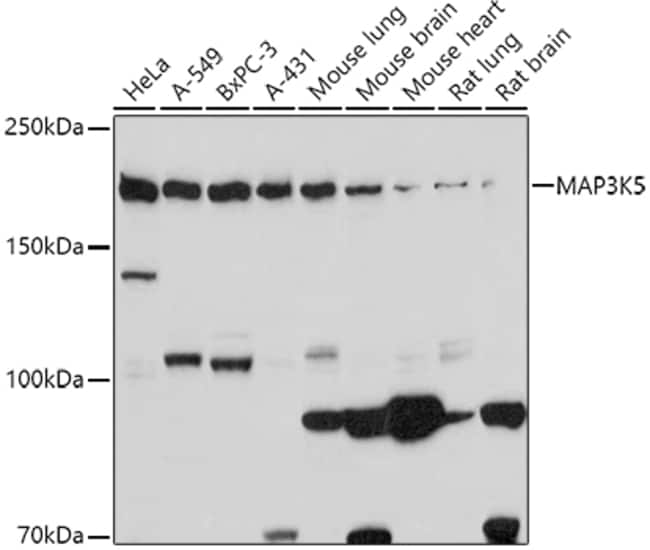 100UL ASK1 ANTIBODY 100 ul