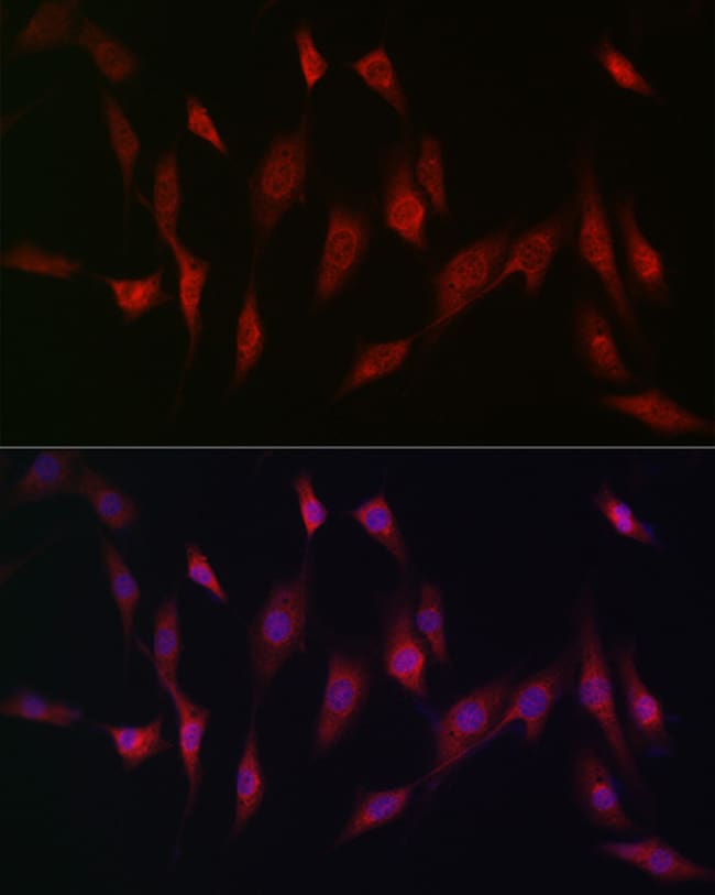 100UL MSRA ANTIBODY 100 ul