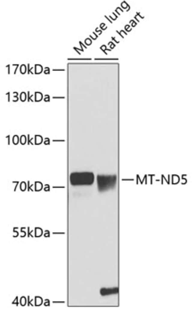 100UL MT-ND5 ANTIBODY 100 ul