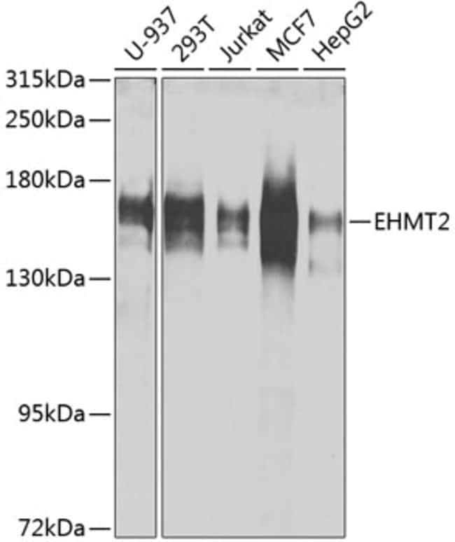 100UL EHMT2 ANTIBODY 100 ul