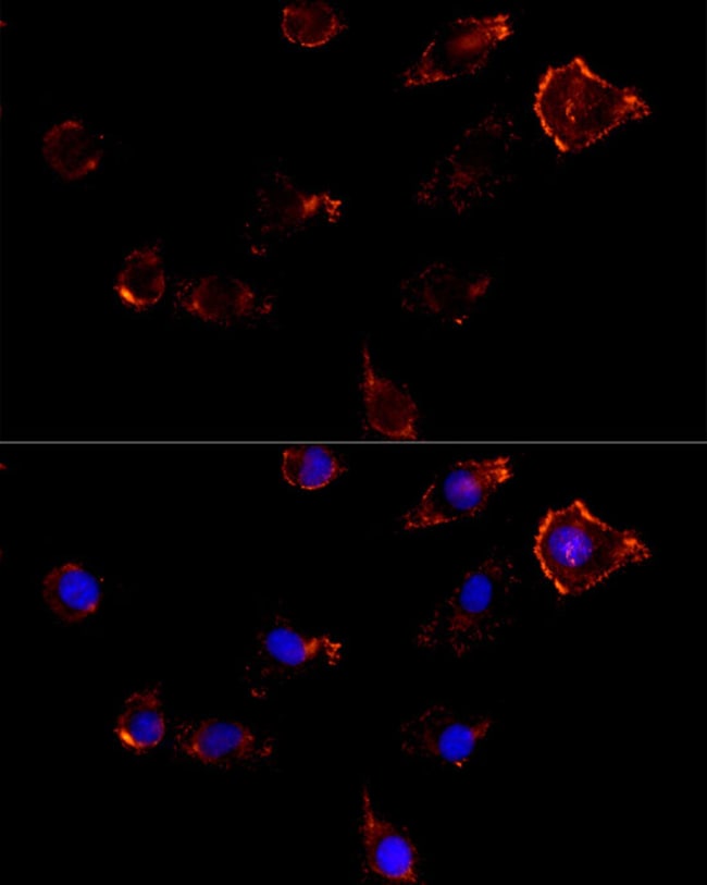 100UL MOESIN ANTIBODY 100 ul