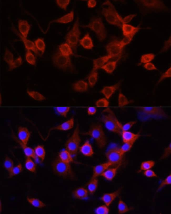 100UL ALPHA-1 ANTITRYPSIN ANTIBODY 100 u