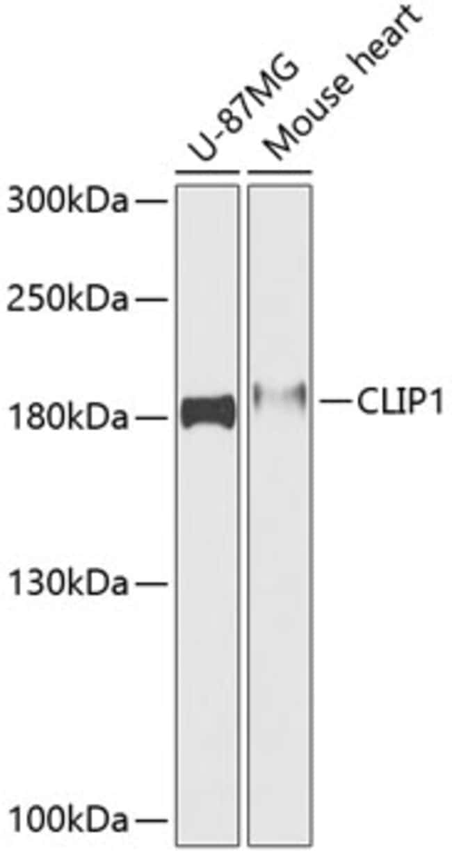 100UL CLIP1 ANTIBODY 100 ul