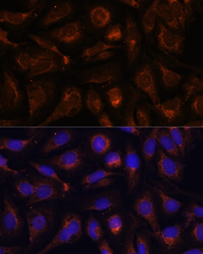 100UL AKT2 ANTIBODY 100 ul