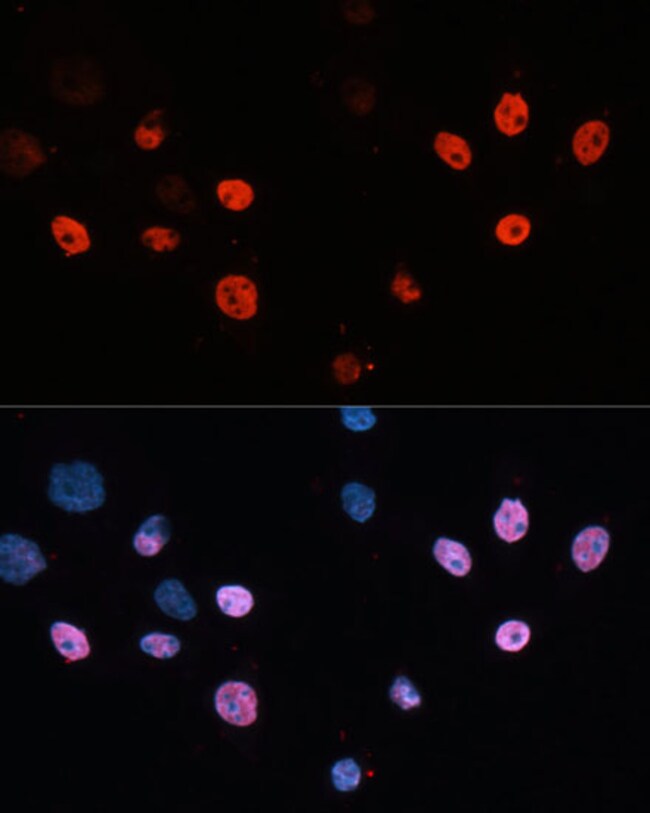 100UL HDAC3 ANTIBODY 100 ul