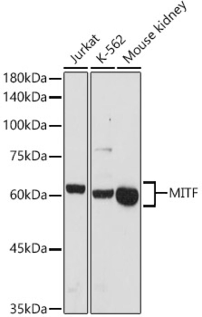 100UL MITF ANTIBODY 100 ul