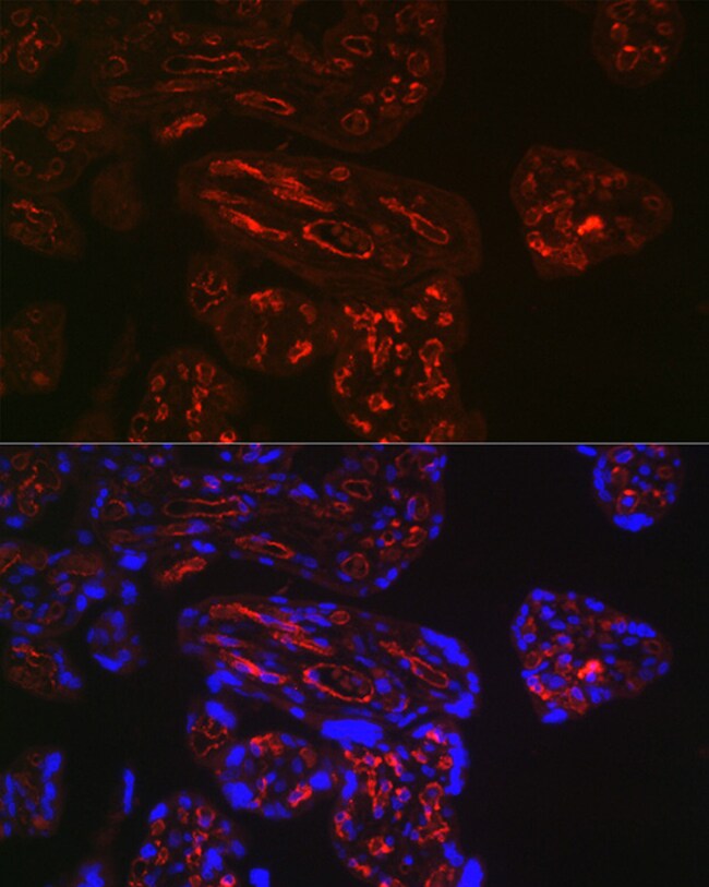100UL CD32B ANTIBODY 100 ul