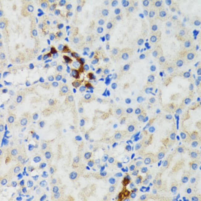 100UL GABARAP ANTIBODY 100 ul