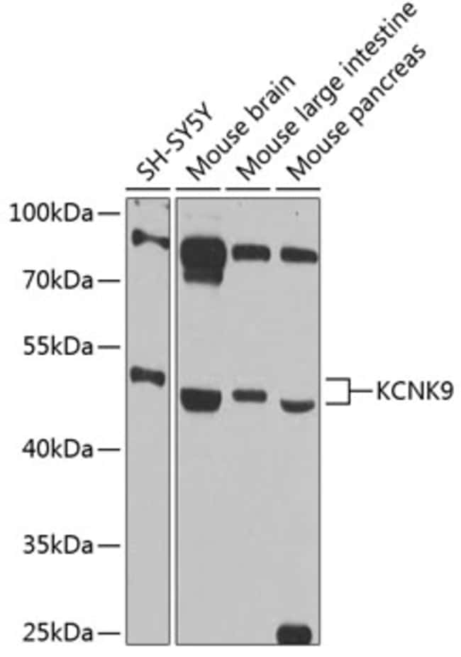 100UL KCNK9 ANTIBODY 100 ul