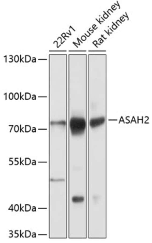 100UL ASAH2 ANTIBODY 100 ul