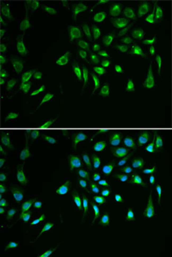 100UL LIVIN ANTIBODY 100 ul