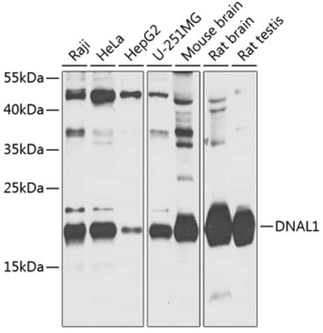 100UL DNAL1 ANTIBODY 100 ul