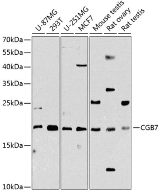 100UL HCG BETA-7 ANTIBODY 100 ul