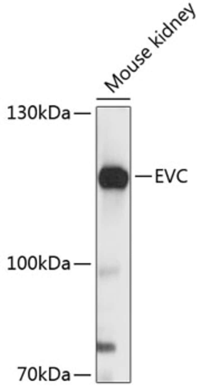 100UL EVC ANTIBODY 100 ul