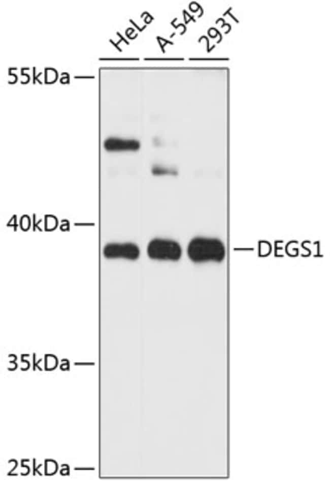 100UL DEGS1 ANTIBODY 100 ul
