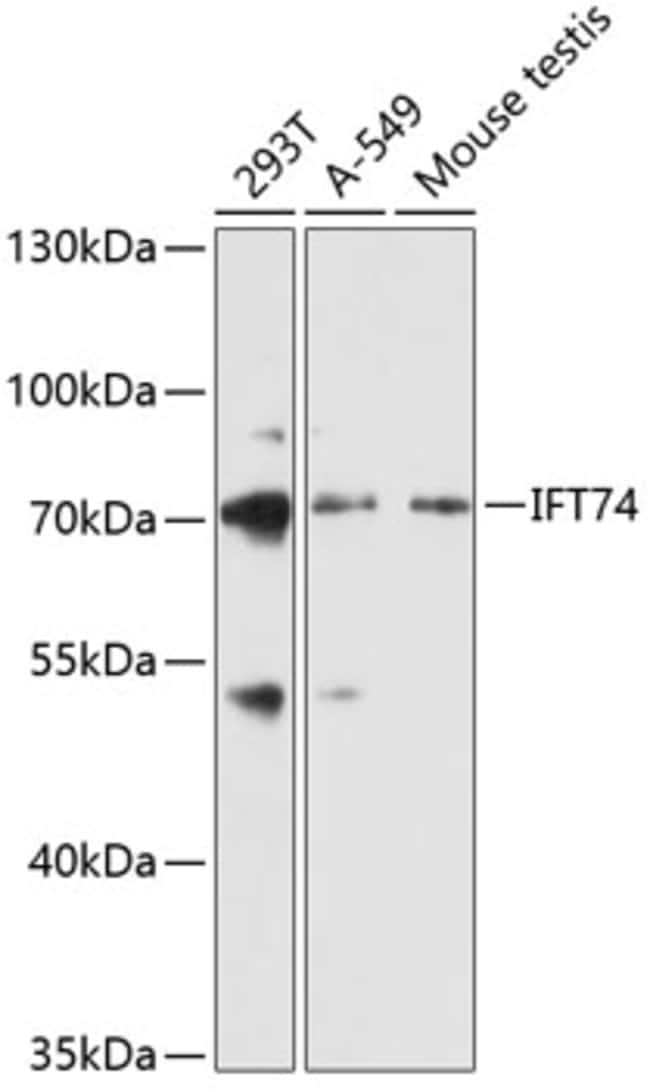 100UL CMG1 ANTIBODY 100 ul