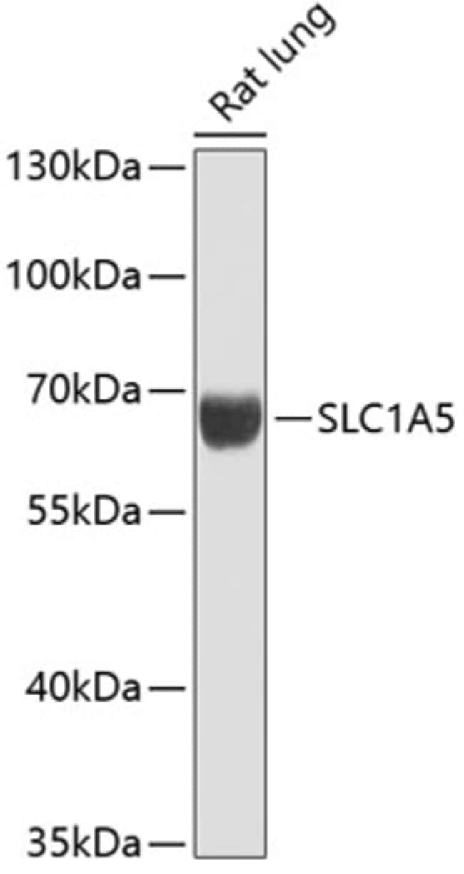 100UL ASCT2 ANTIBODY 100 ul