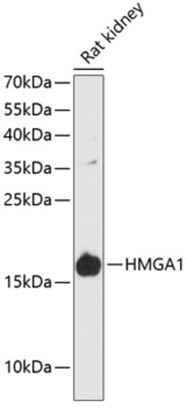 100UL HMGA1 ANTIBODY 100 ul