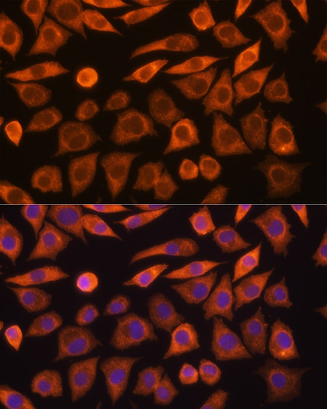 100UL GUCY1A3 ANTIBODY 100 ul