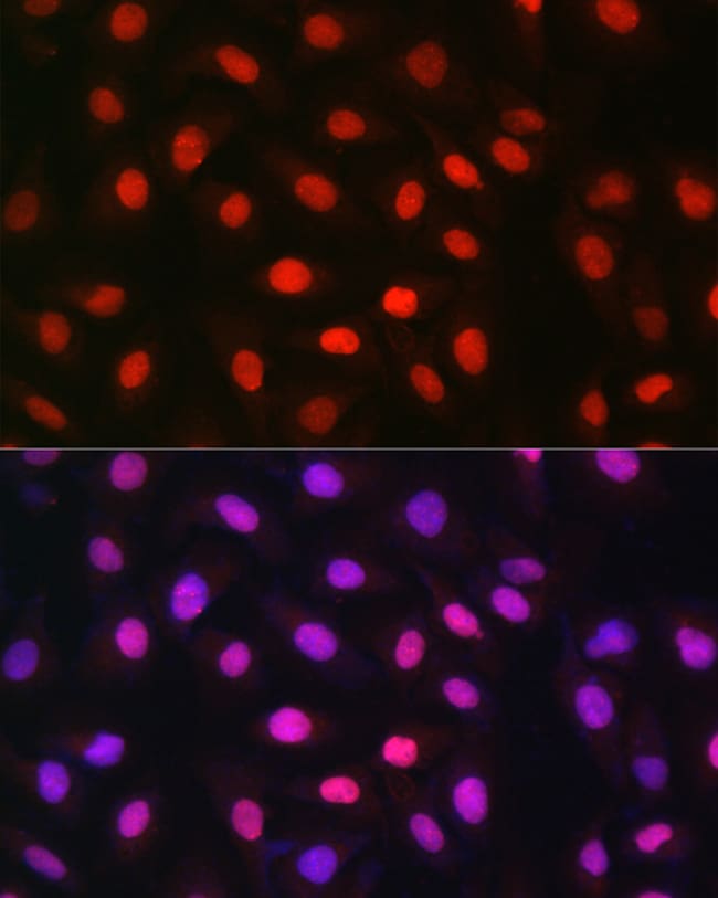 100UL MDC1 ANTIBODY 100 ul