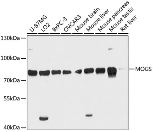 100UL GCS1 ANTIBODY 100 ul