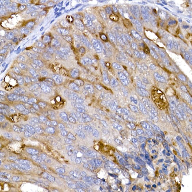 100UL ACE2 ANTIBODY 100 ul