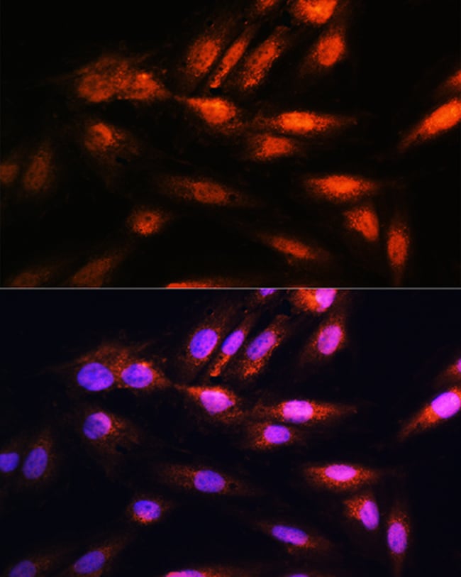 100UL COPS8 ANTIBODY 100 ul