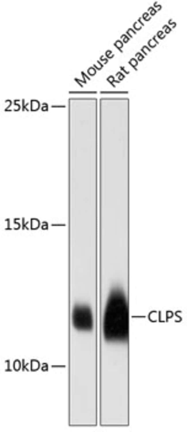 100UL CLPS ANTIBODY 100 ul