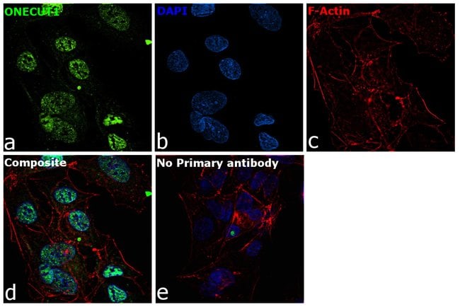100UL HNF6 ANTIBODY 100 ul