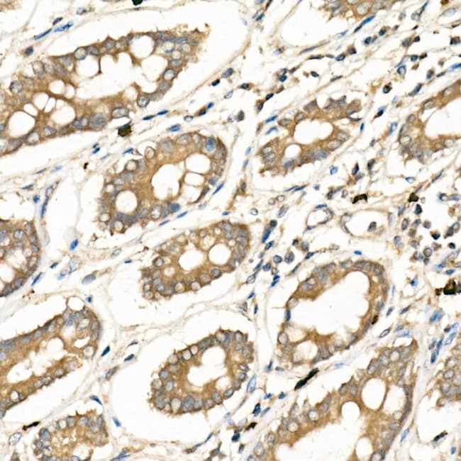 100UL FZD5 ANTIBODY 100 ul