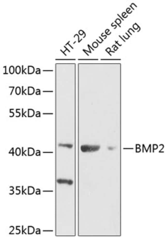 100UL BMP-2 ANTIBODY 100 ul