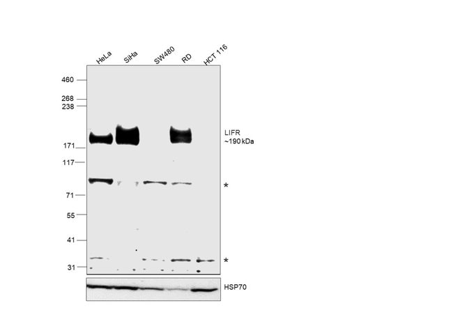100UL LIFR ANTIBODY 100 ul
