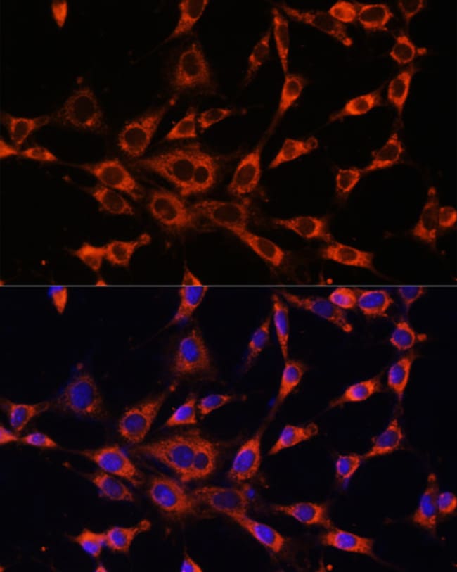 100UL ITPR3 ANTIBODY 100 ul