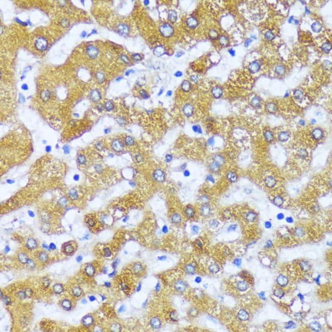 100UL ACOX2 ANTIBODY 100 ul