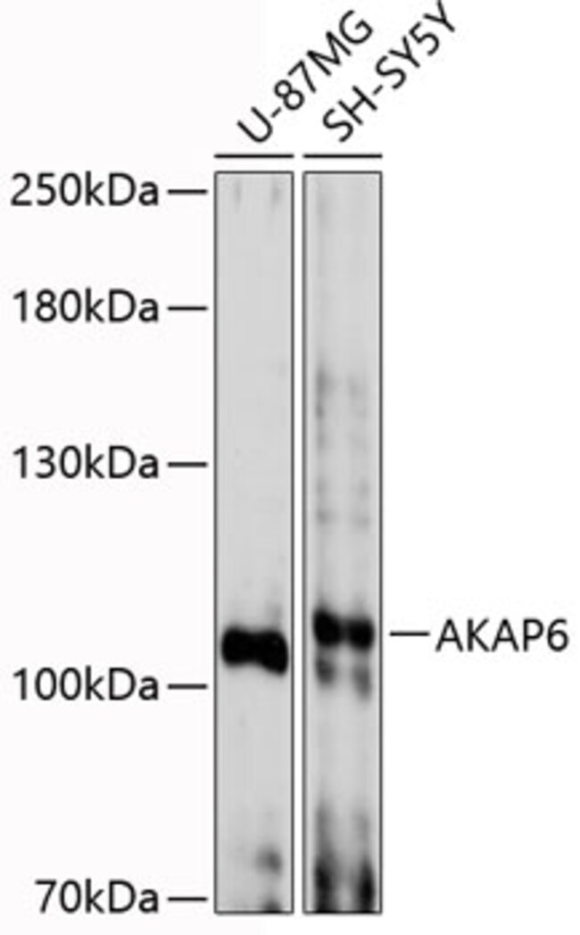 100UL AKAP6 ANTIBODY 100 ul