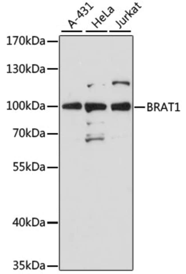 100UL BAAT1 ANTIBODY 100 ul
