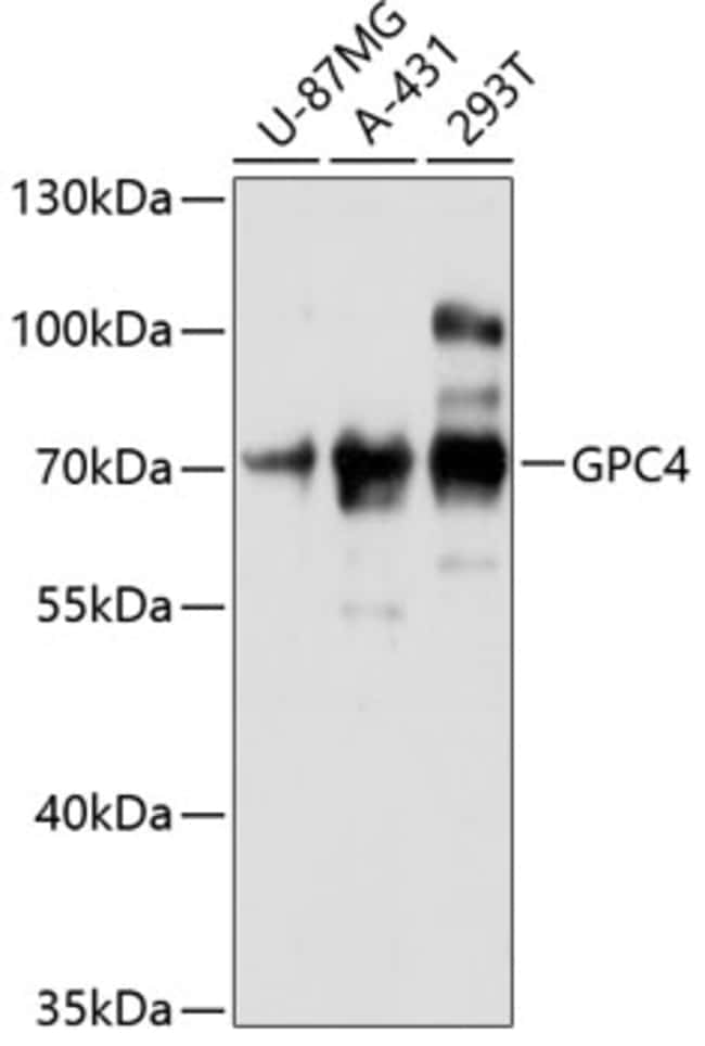 100UL GLYPICAN 4 ANTIBODY 100 ul