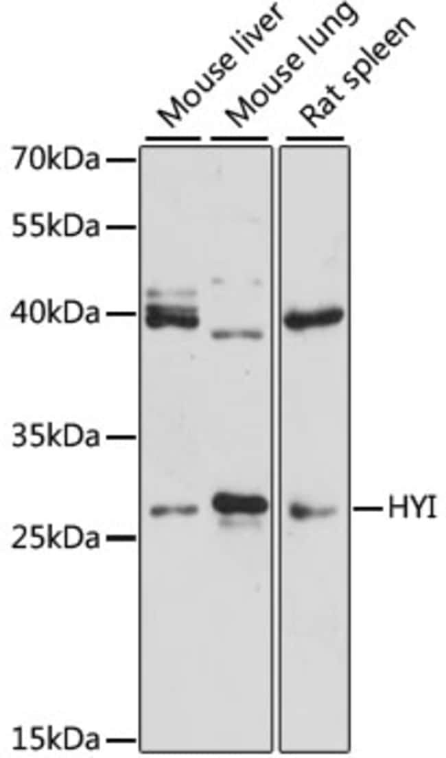 100UL HYI ANTIBODY 100 ul
