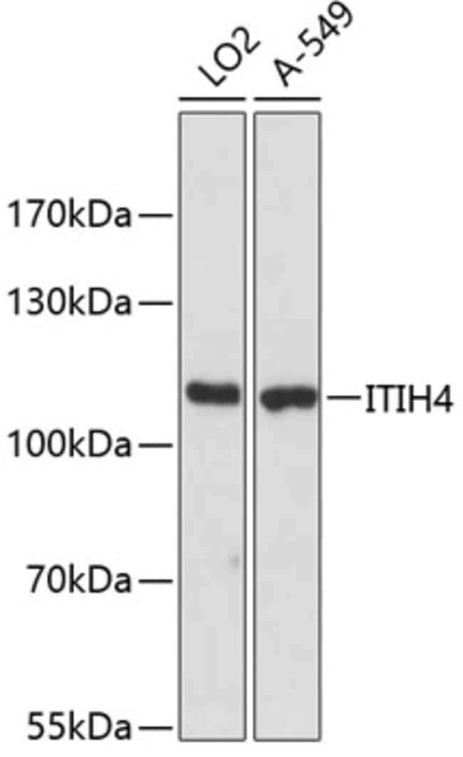 100UL ITIH4 ANTIBODY 100 ul