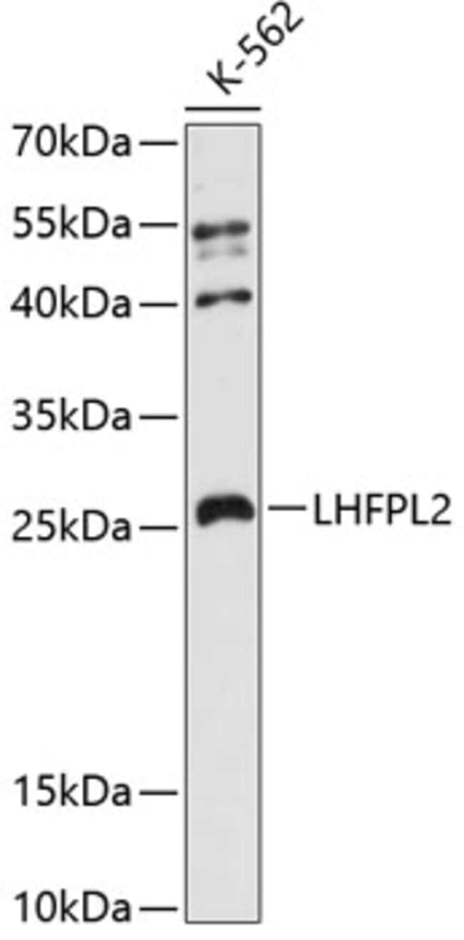 100UL LHFPL2 ANTIBODY 100 ul