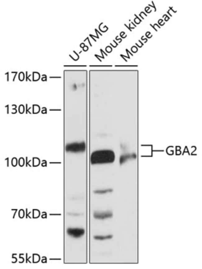 100UL GBA2 ANTIBODY 100 ul