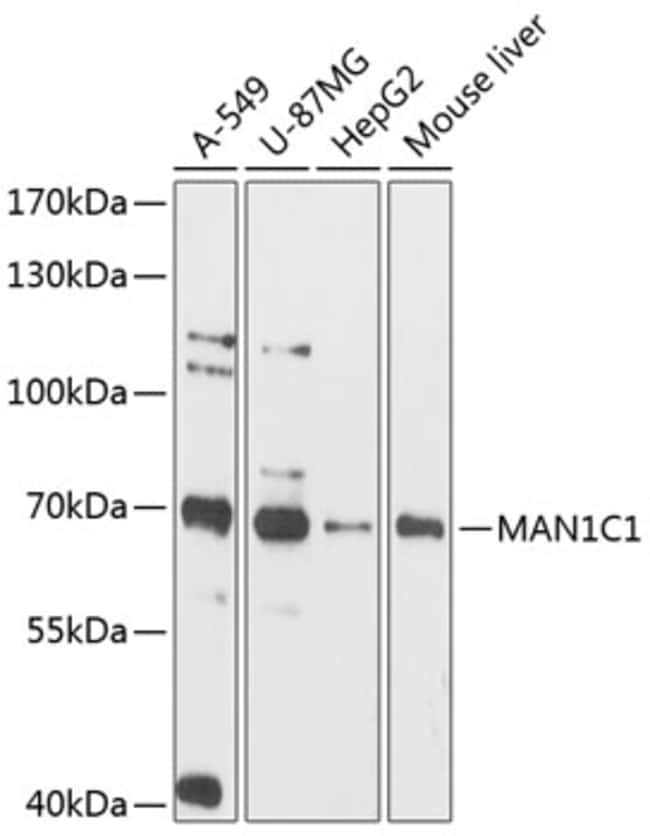 100UL MAN1C1 ANTIBODY 100 ul