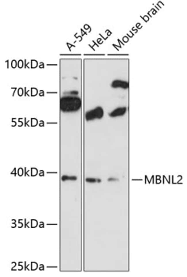 100UL MBNL2 ANTIBODY 100 ul