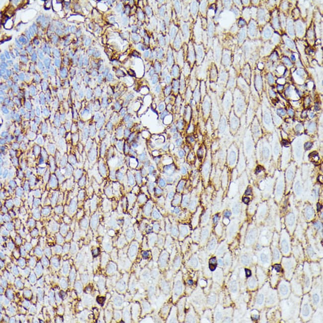 100UL HLA-B ANTIBODY 100 ul