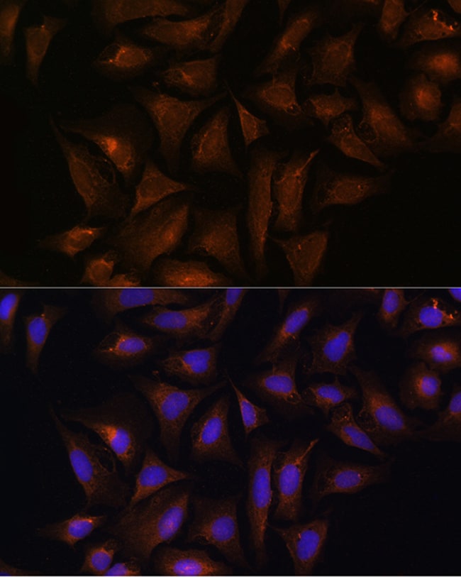 100UL CRYZ ANTIBODY 100 ul