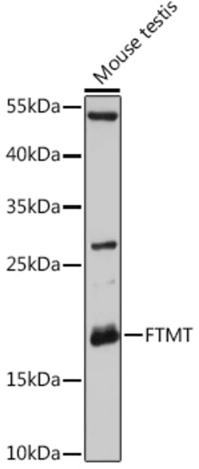 100UL FTMT ANTIBODY 100 ul
