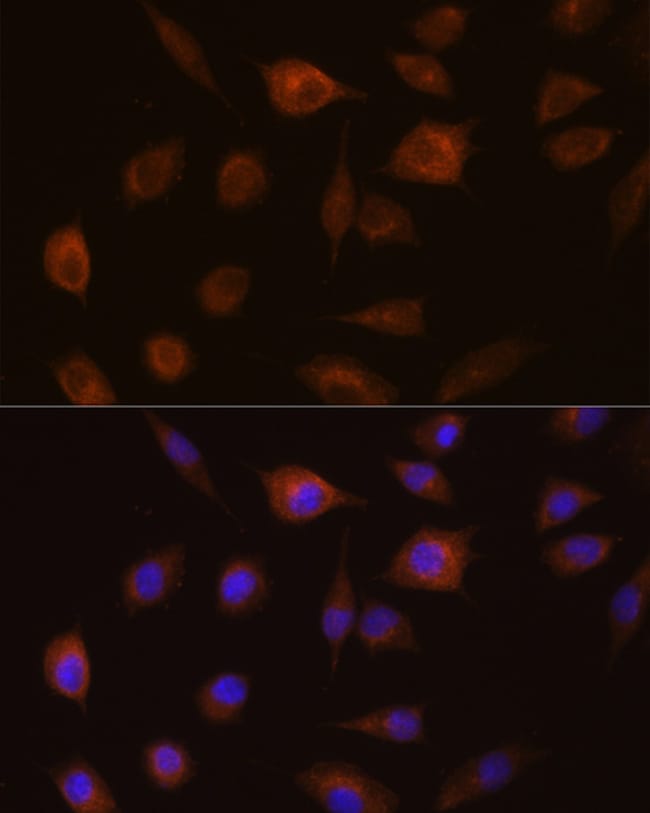 100UL GSTT1 ANTIBODY 100 ul