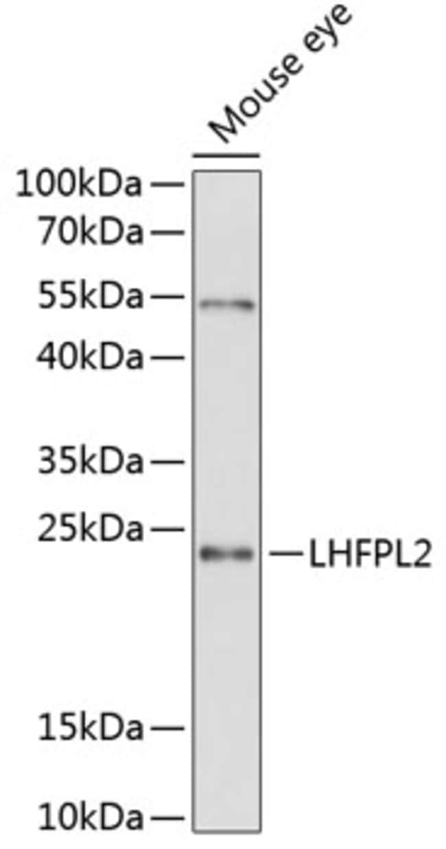 100UL LHFPL2 ANTIBODY 100 ul