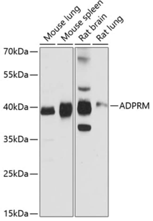 100UL C17ORF48 ANTIBODY 100 ul